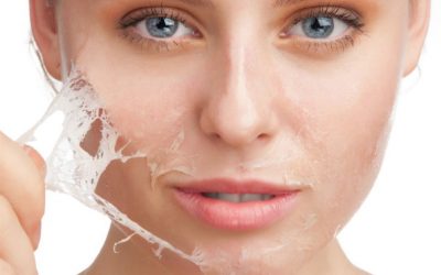 Pele bonita e saudável, através dos peelings químicos