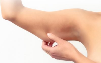 Flacidez, o terror do público feminino