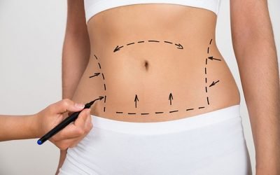 Cosmetologia associada a eletroterapia aplicada ao pré e pós-operatório de cirurgia plástica