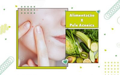 Mês de combate à acne: Alimentação x pele acneica!