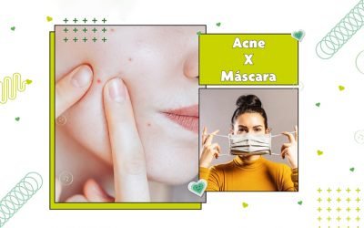 Maskne: O que é e como evitar?