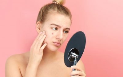 HÁBITOS X A SAÚDE DA PELE